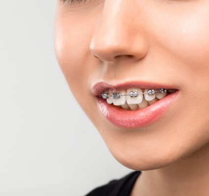 علاج العضة المفتوحة