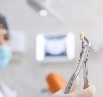 خلع ضرس العقل